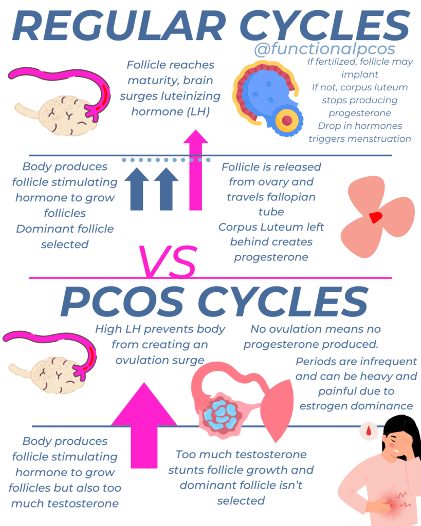 graphic of PCOS menstrual cycle difference to regular periods